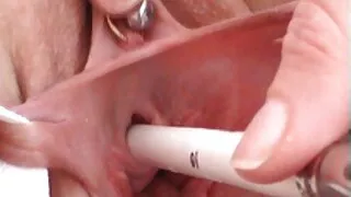 Béo sẵn sàng phim xet m nga Chọc